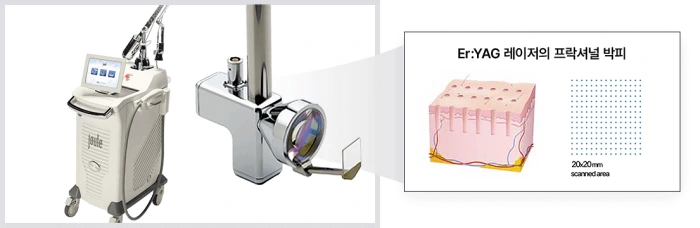 إعادة التسطيح الجزئي للبشرة