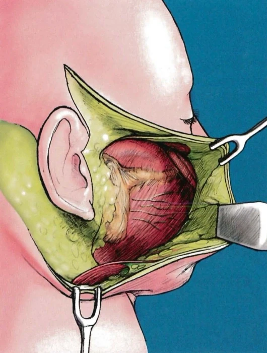 شد الوجه العميق