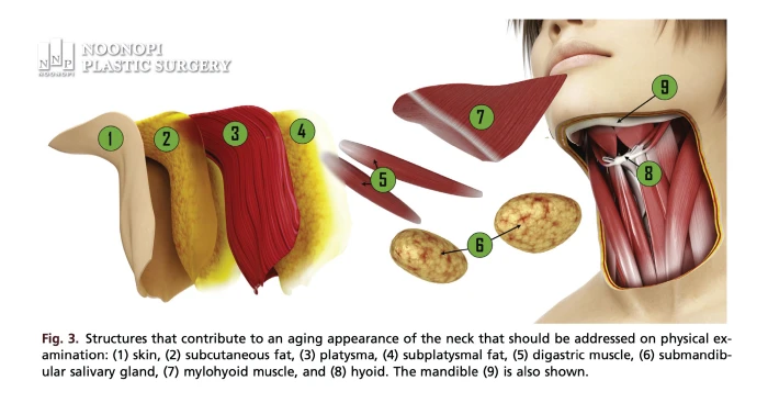 Neck Anatomy Illustration