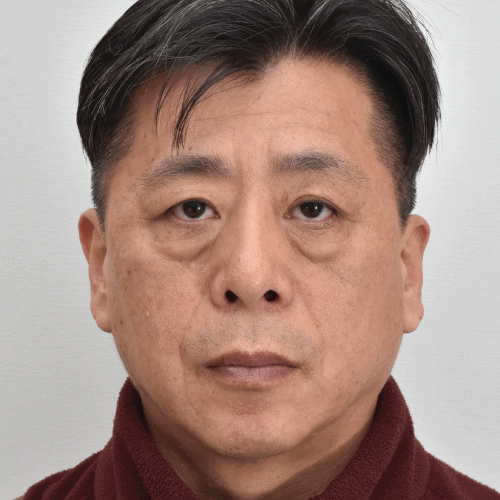 下睑手术术后6周