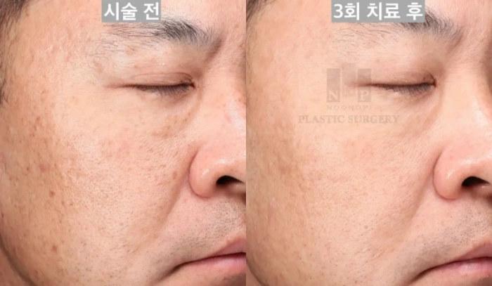 피부결도 개선된 모습