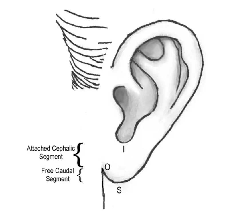 ميزات شحمة الأذن الجمالية