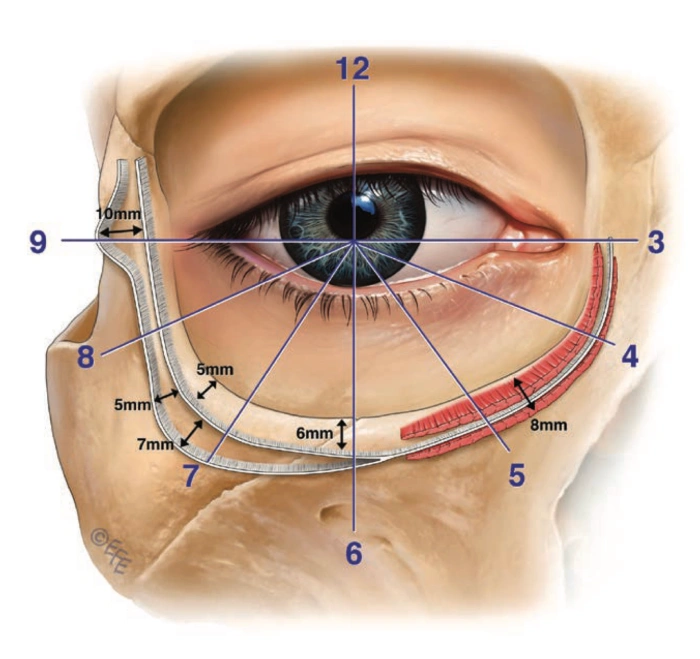 رسم توضيحي تشريحي يوضح الرباط المحيط بالمدار