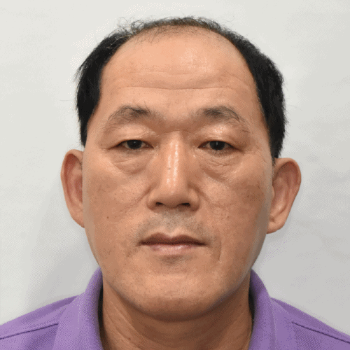 lower blepharoplasty man