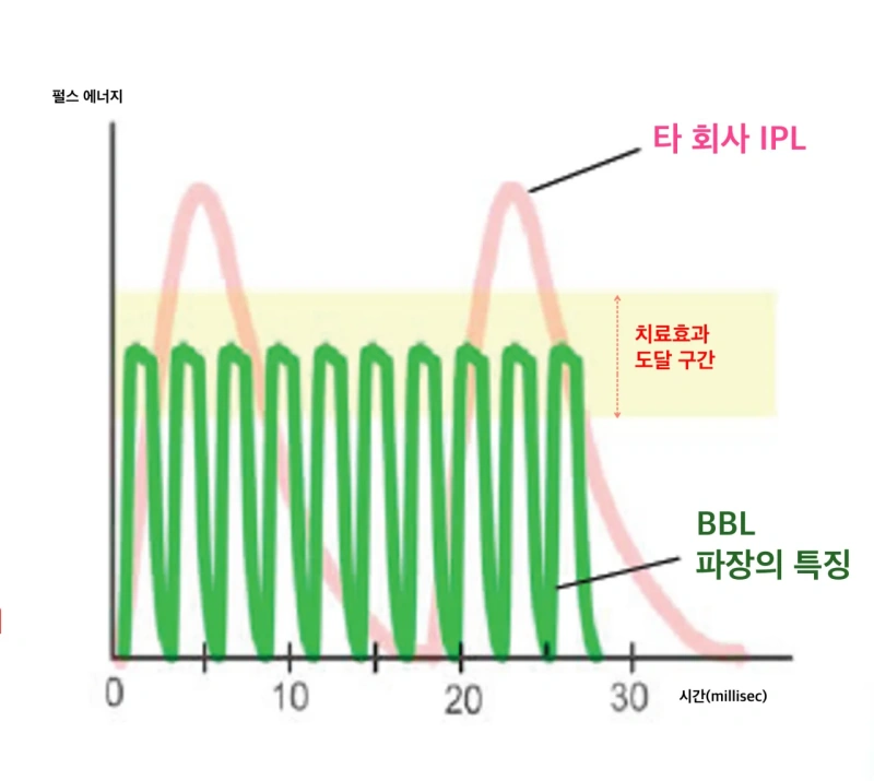 BBL's Square pulse shape(Green) vs traditional IPL(Pink)