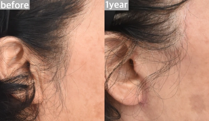 على طول حافة شق الصنج، تكبير