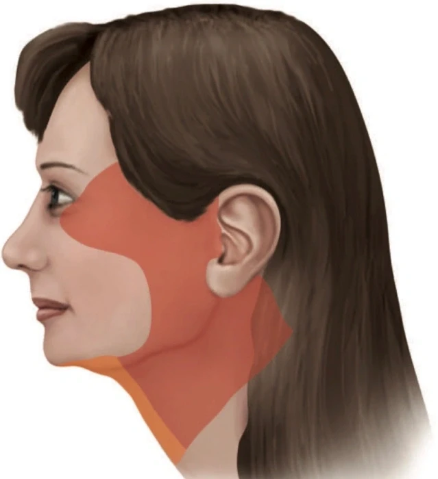 منطقة تشريح الجلد للدكتور كونيل في الوجه القوقازي