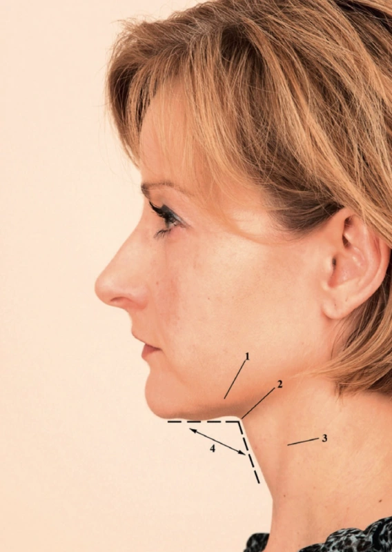 ideal aesthetic neck