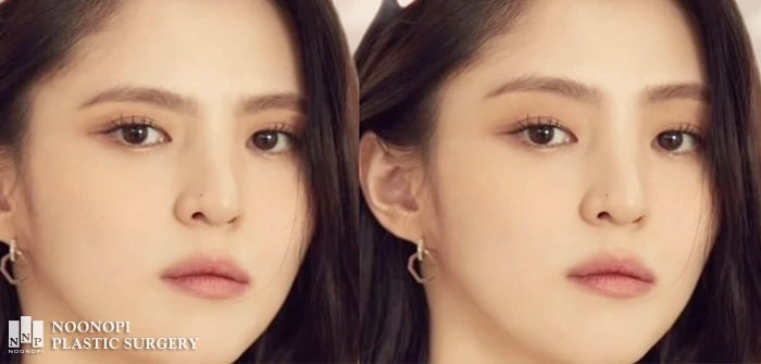 The distance between the eyes and eyebrows affects a person's overall expression