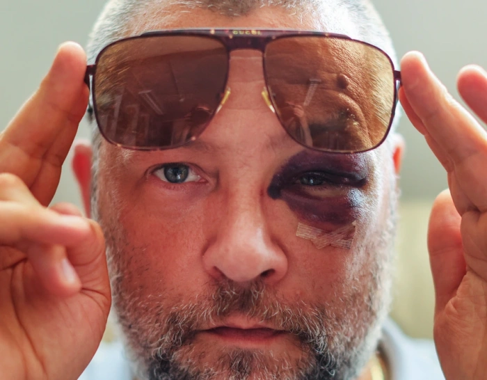 الورم الدموي سريع النمو يمكن أن يكون خطيرًا