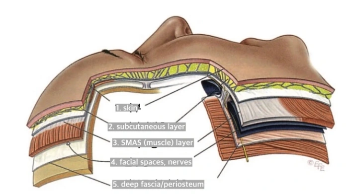 facial anatomy SMAS layer