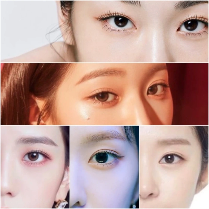 各类双眼皮形态