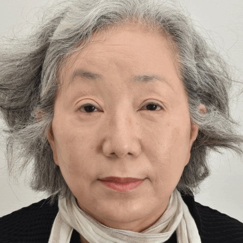 术前：老年患者常会不自觉地扬起眉毛以改善视力。