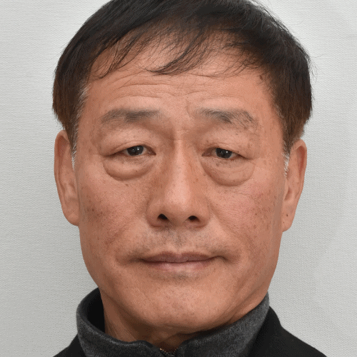 眉下提升术与下睑成形术前后对比：  术后明显眉下垂