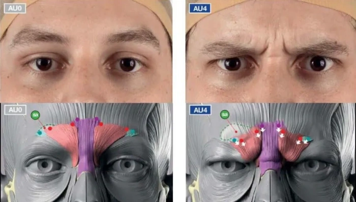 العضلات المسؤولة عن خطوط التجاعيد بين الحاجبين