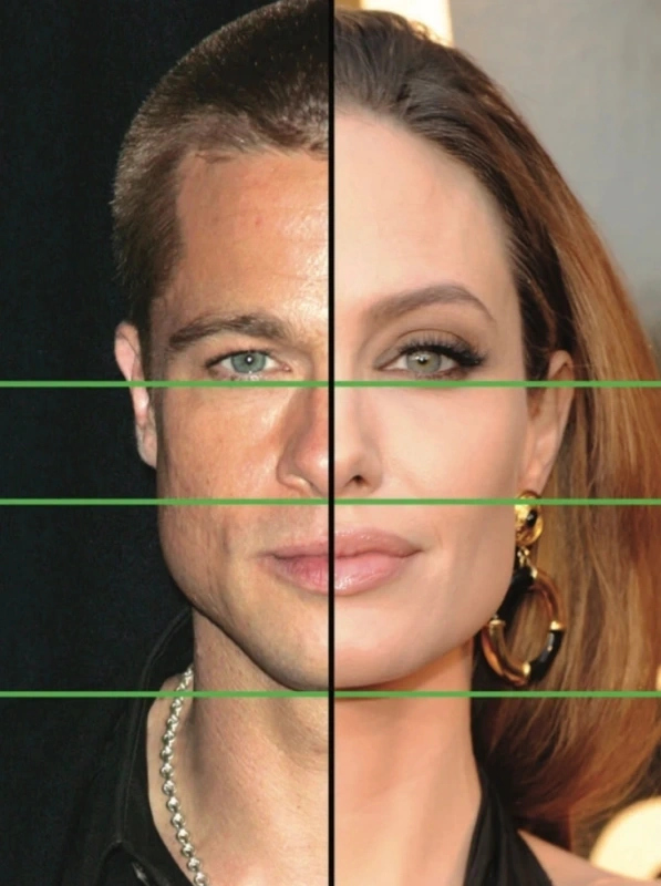 ينقسم الوجه إلى ثلاثة أجزاء: الجزء العلوي والوسطى والسفلي.