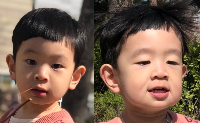 跑步时面部晃动瞬间，可见嘴角两侧的悬吊韧带正支撑着面部结构