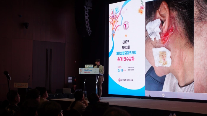 高压氧疗法在整形手术恢复中的应用