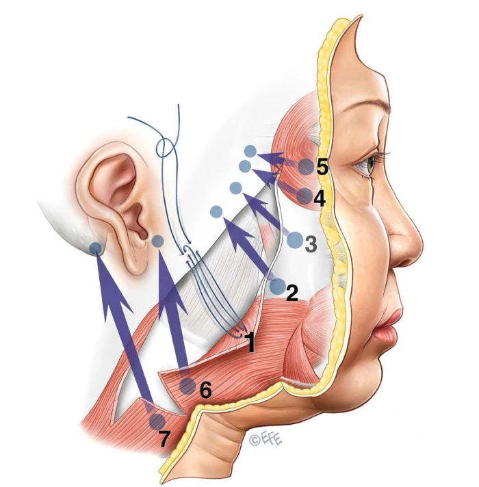 mportance of releasing retaining ligaments and facial spaces