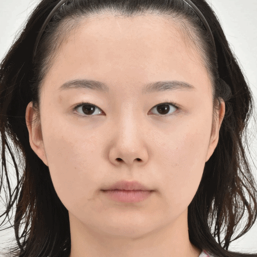 قبل وبعد جراحة تدلي الجفن