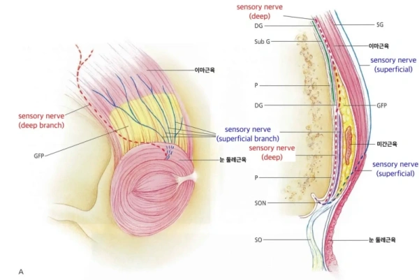 Supraorbital nerve and glabellar muscle anatomy