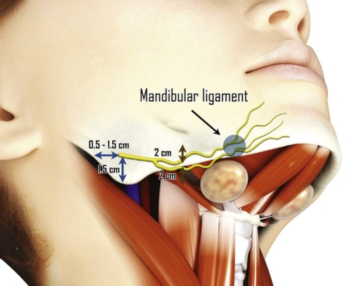 تلف الأعصاب