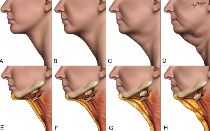 火鸡脖与年龄相关