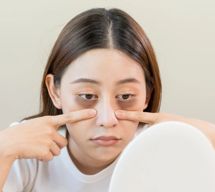 꺼진 눈밑과 다크서클