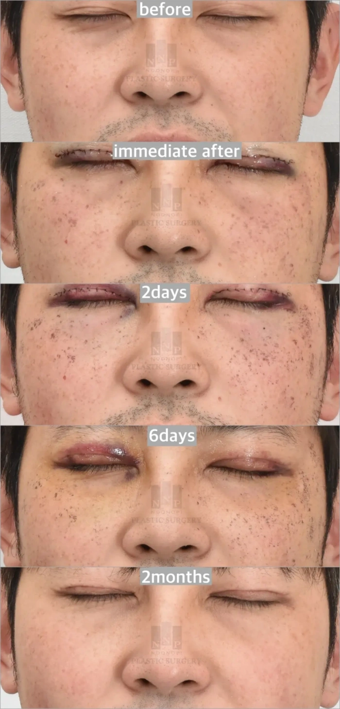 نتائج جلسة BBL واحدة