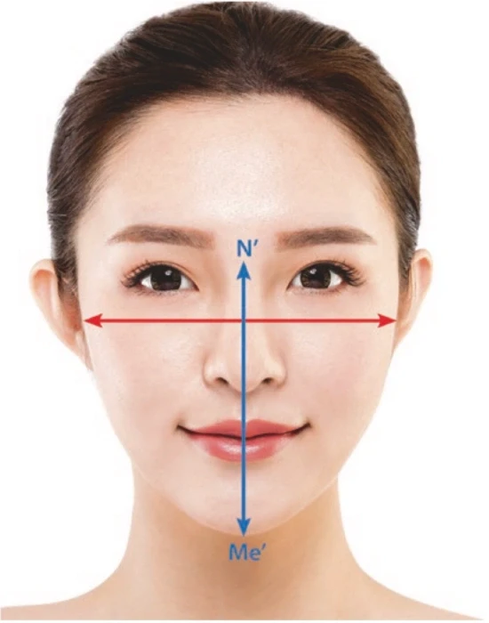 يميل الآسيويون إلى امتلاك دعامة هيكلية أقوى مقارنة بالقوقازيين