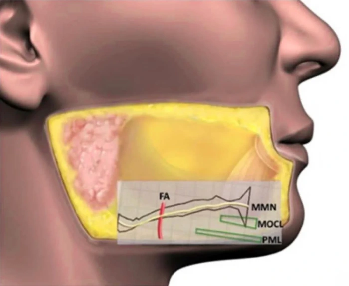 facial retaining ligaments and nerve pathways
