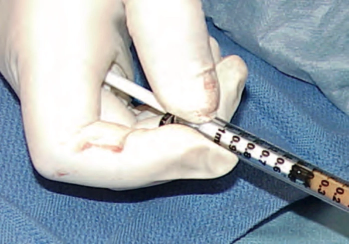 correct injection methods for successful survival