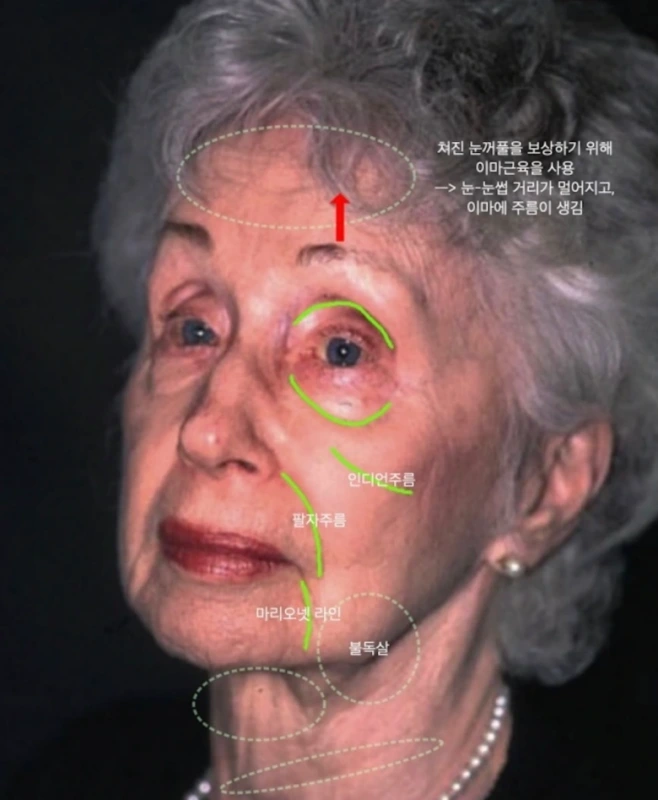 나이든 얼굴의 특징