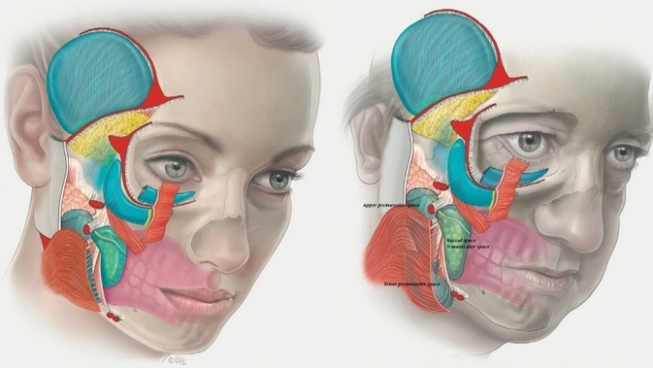 Aging face change in soft tissue