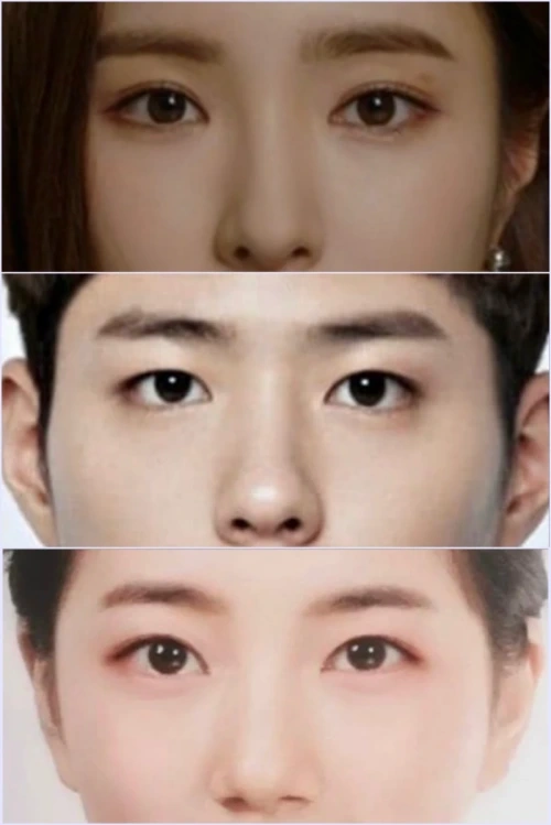 年轻明亮的眼神通常暴露85-95%的虹膜