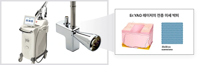 تجديد سطح الجلد بالاستئصال الكامل