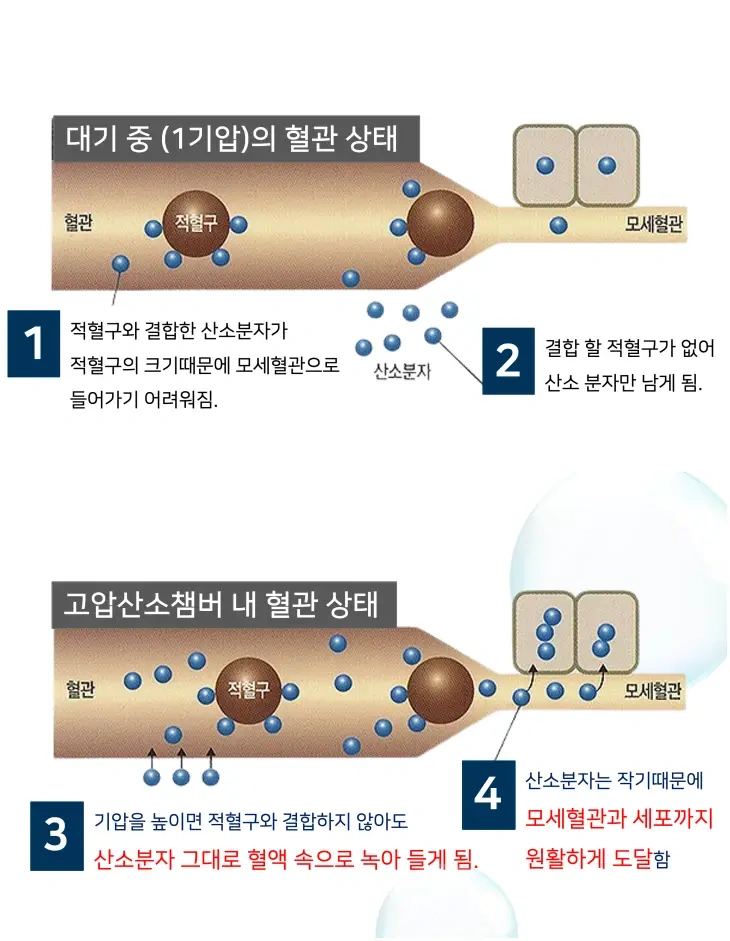 高压氧环境下红细胞氧输送量提升