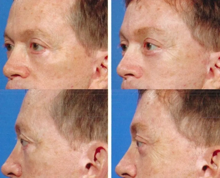 غياب السوالف