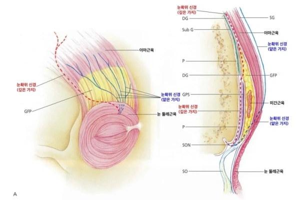眶上神经与眉间肌解剖结构