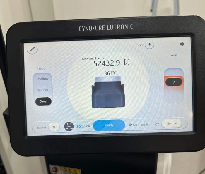 كمية الطاقة لـ 300 جرعة من XERF في Noonopi