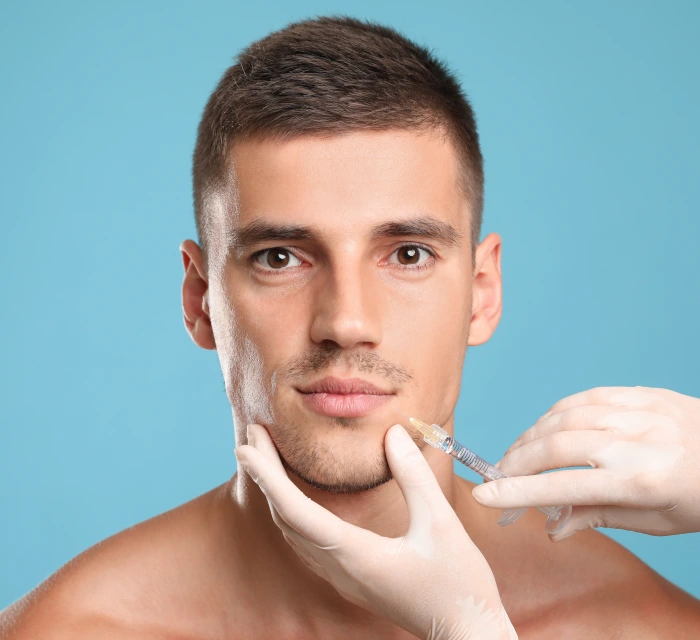 الحشو لعلاج خطوط الماريونيت