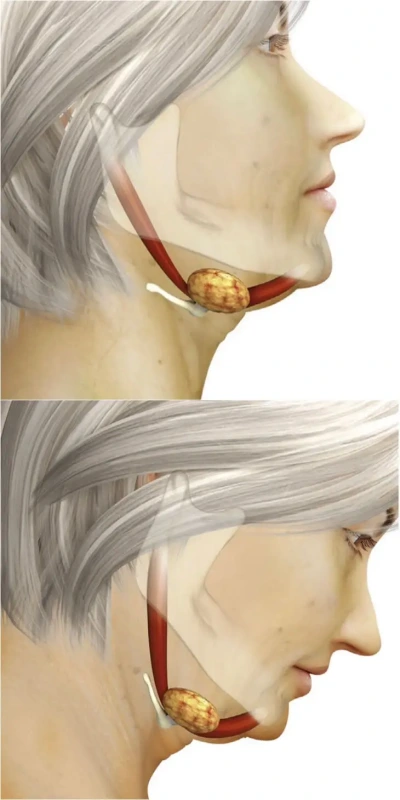 Gland are easily visible when looking down