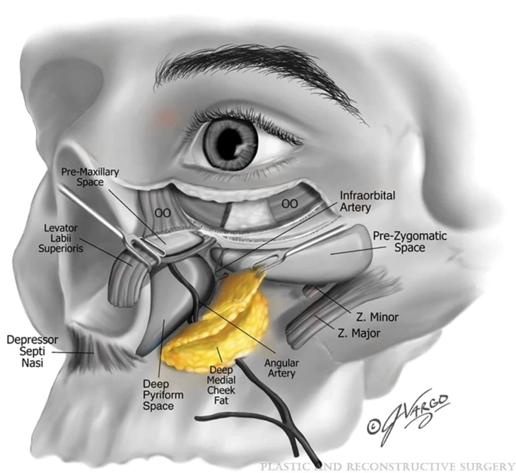 deep medical cheek fat illustration